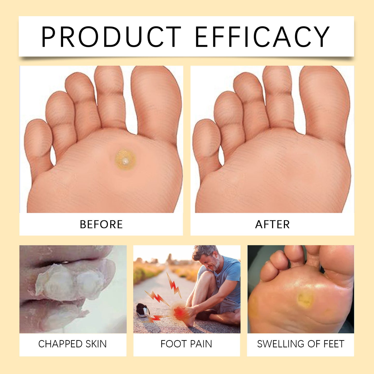 Alleviate Foot Swelling, Care And Moisturize Spray